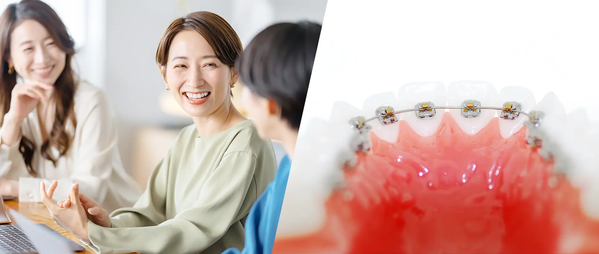 普段と変わらず生活できる舌側矯正(リンガル矯正)
