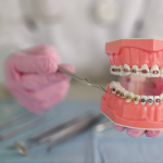 小児矯正は意味ない？治療を行うメリットについて解説