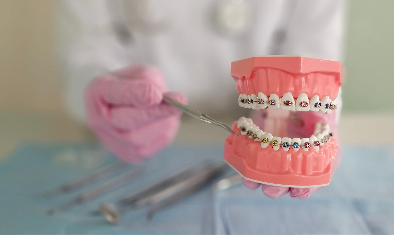 小児矯正(一期治療)は意味ない?治療を行うメリットについて解説